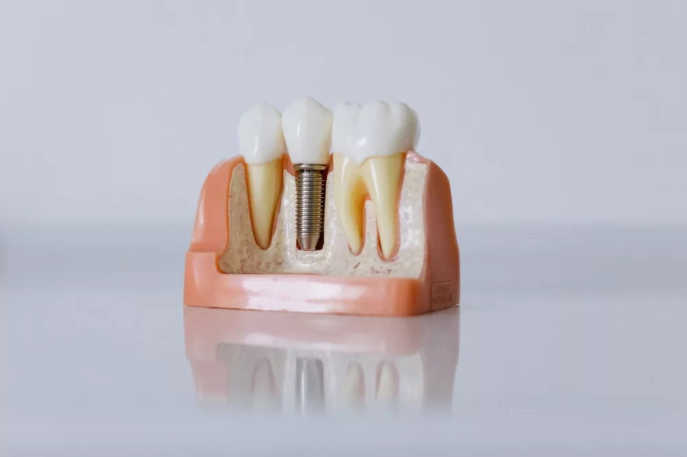 A Comprehensive Look at Spirit Dental Insurance: My Honest Take